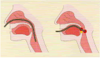 経鼻法・経口法による挿入